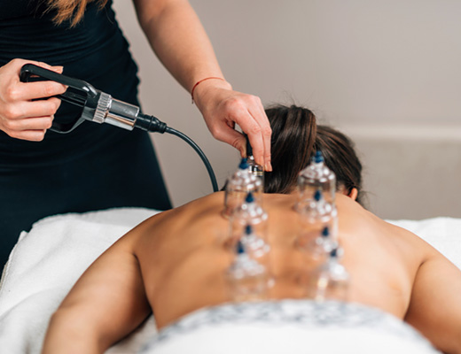 Massage_Cupping